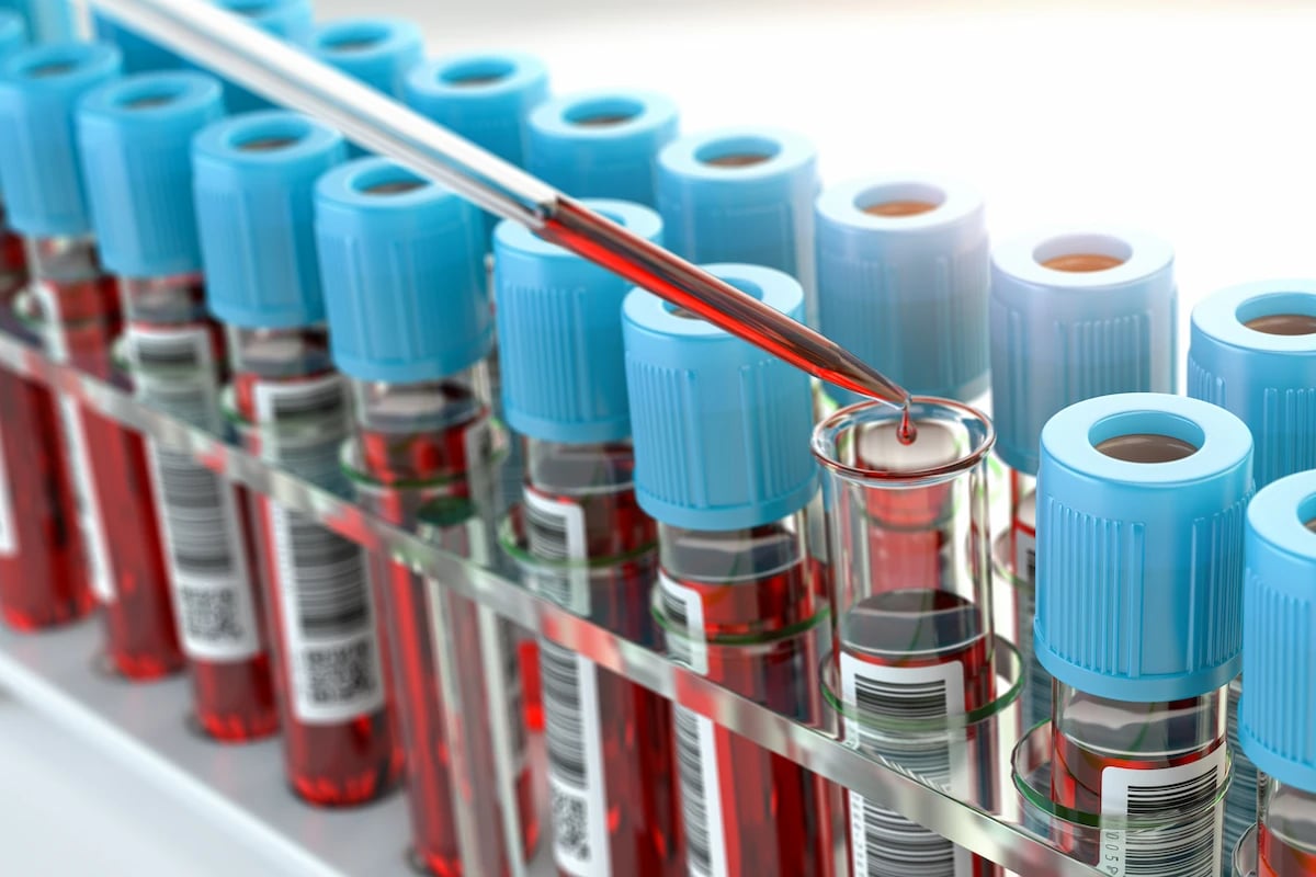 Échantillons biologiques - Cellules viables - Échantillons de la biopuce